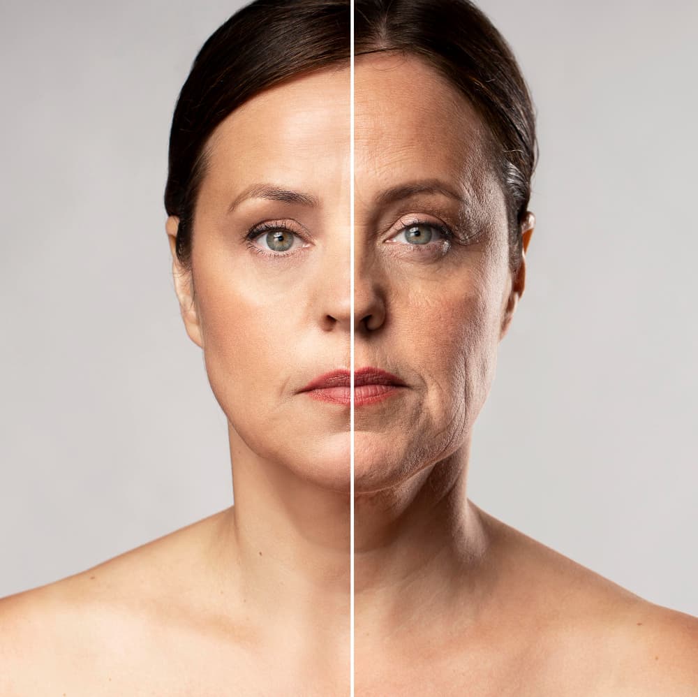 Skin Boosters